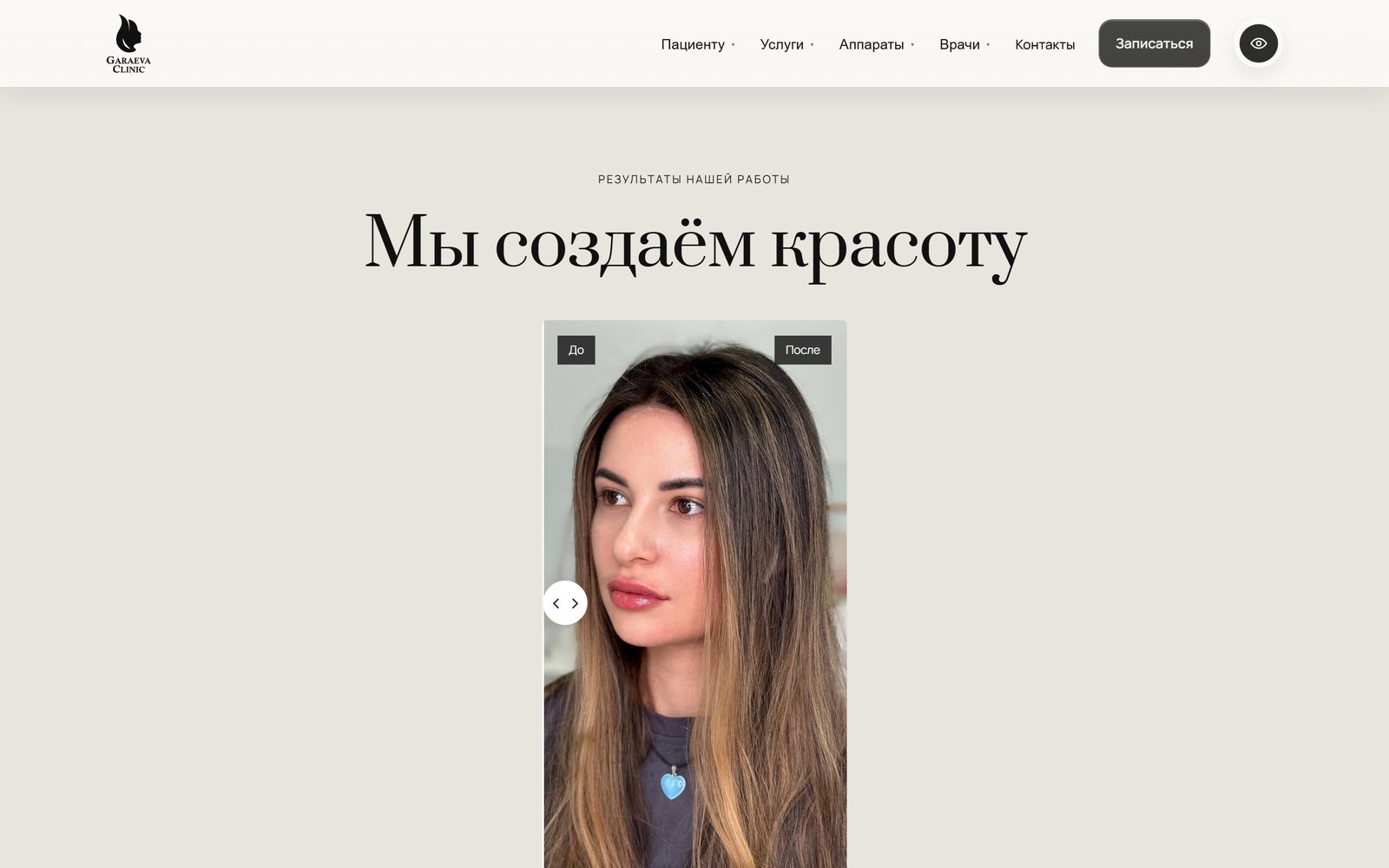 Слайдер «до и после» на сайте клиники